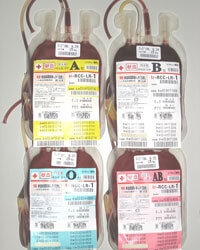 照射赤血球濃厚液（RCC）